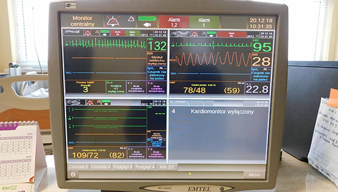 Szpital kupił kardiomonitory i centralę monitorującą za 97.200 zł. (Fot. SP ZOZ)
