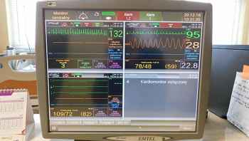 Szpital kupił kardiomonitory i centralę monitorującą za 97.200 zł